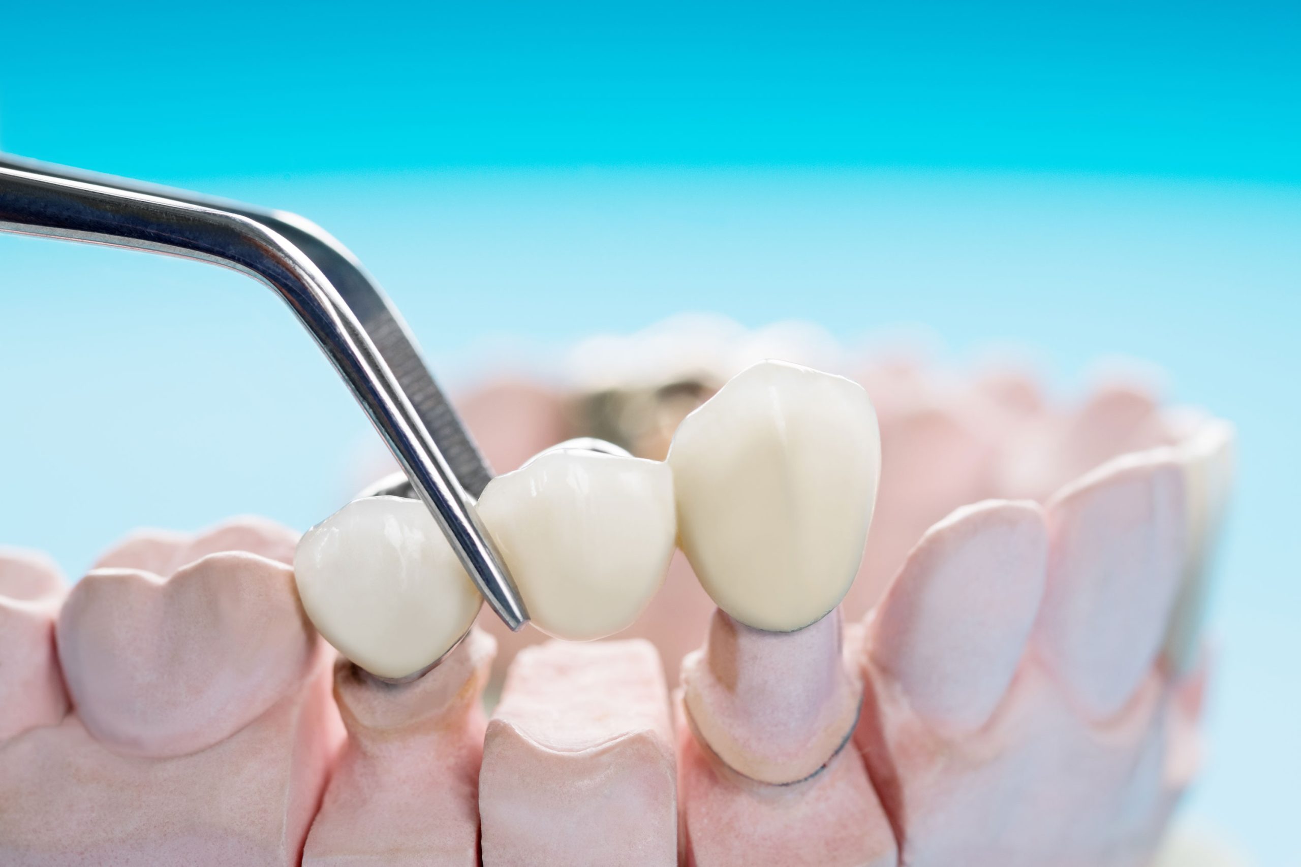 Dental care
